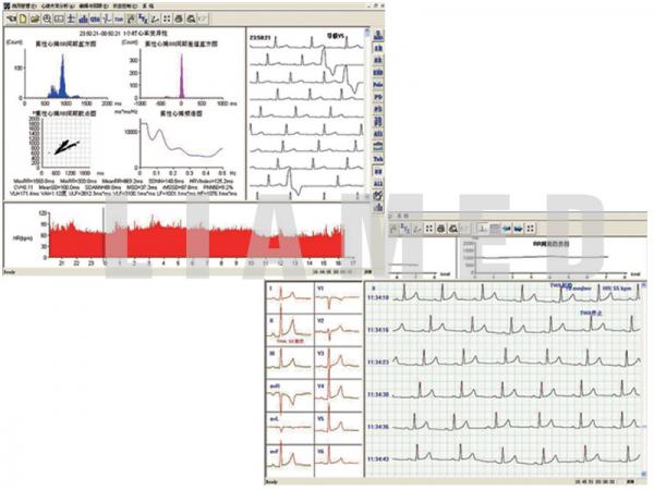 Examinare făcută cu Holter ECG TLC5000 
