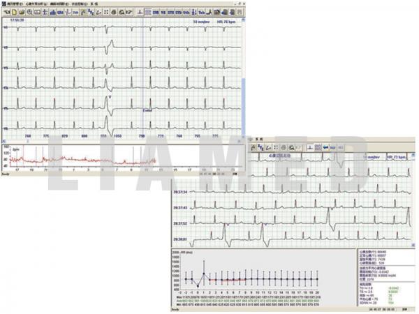 Examinare făcută cu Holter ECG TLC5000 