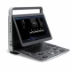 Ecograf portabil SonoScape E1V 