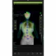 Examinare făcută cu Dispozitiv pentru analiza coloanei vertebrale SPINE 3D fara platforma 