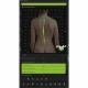 Examinare făcută cu Dispozitiv pentru analiza coloanei vertebrale SPINE 3D fara platforma 