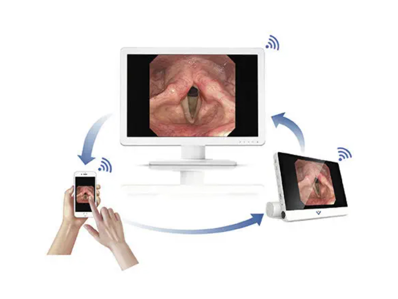 Videonazofaringoscop flexibil EF28 cu monitor VS50B 