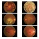 Fundus camera RETICAM 3100 MAIN MEDITECH 