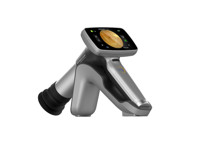 Fundus camera LUNA PLUS 