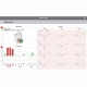 Examinare făcută cu Electrocardiograf MINDRAY BENEHEART R700 