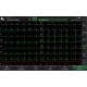 Examinare făcută cu Electrocardiograf MINDRAY BENEHEART R700 