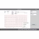 Examinare făcută cu Electrocardiograf MINDRAY BENEHEART R700 