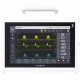 Aparat portabil ventilare UVENT-M-S 