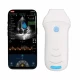 Ecograf ultraportabil wireless phased array C10CW 