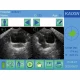 Examinare făcută cu Scanner vezica urinara BVT01 