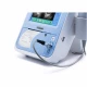 Scanner vezica urinara BVT01 