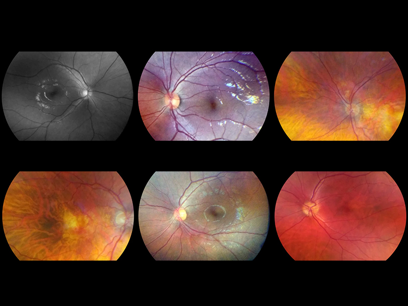 Fundus camera VISTA VIEW VOLK 