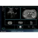 Examinare făcută cu Modul fuziune SonoFusion CT, RMN pentru ecograful SonoScape S80 