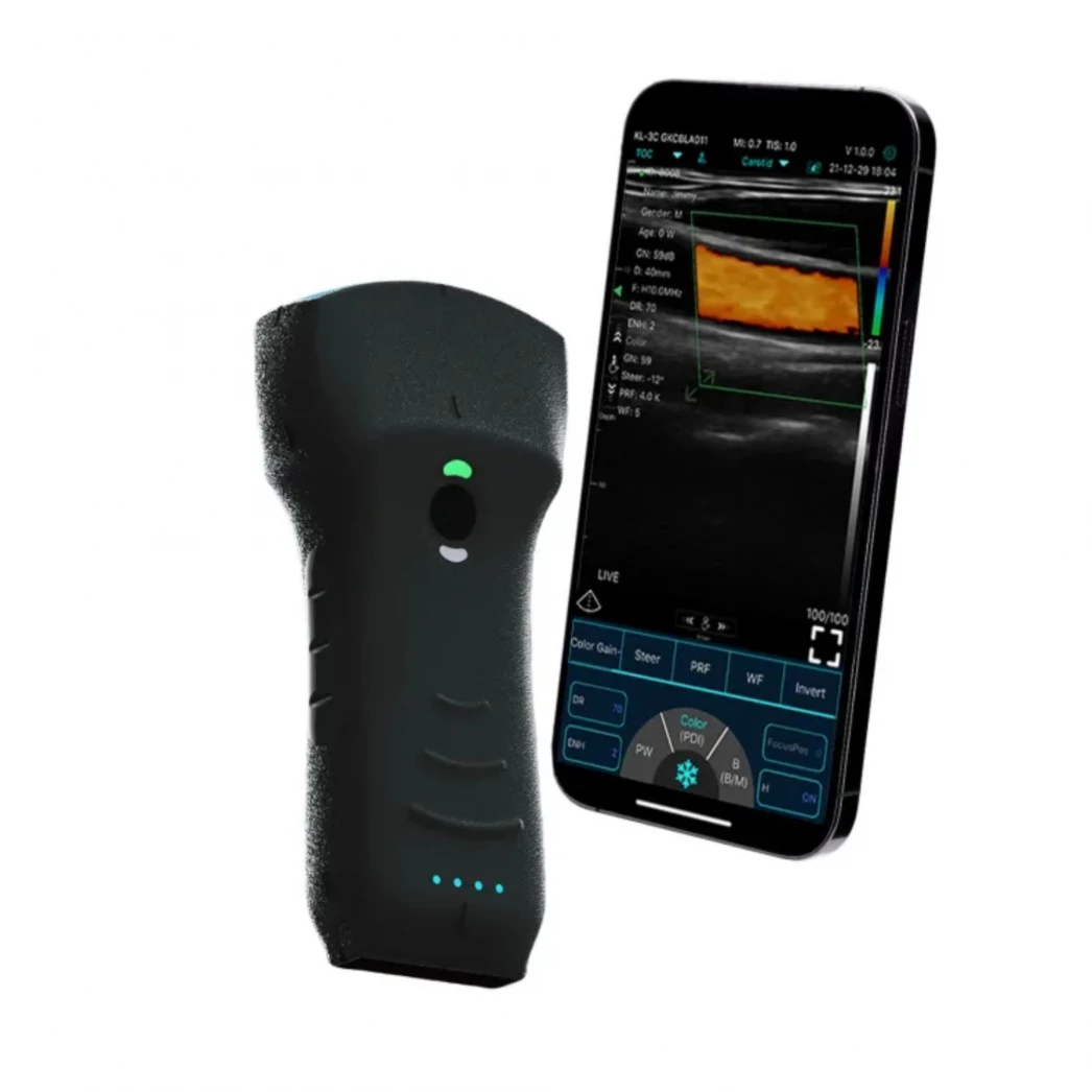 Ecograf ultraportabil wireless dual liniar-convex C10TX Pro 