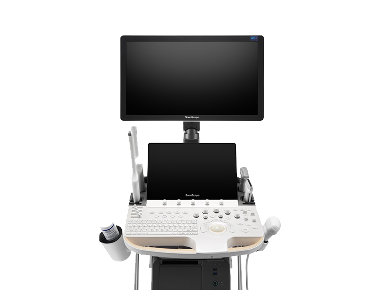Ecograf stationar SonoScape P60 