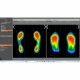 Examinare făcută cu Banda de alergare senzoriala pentru analiza baropodometrica RUNTIME 